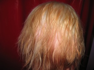 Freshly bleached hair